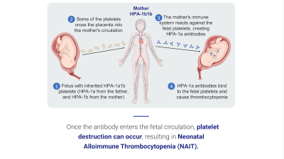 NHS BT - HI mother hpa-1b1b v1 carousel